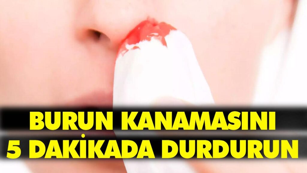 BURUN KANAMASINA DİKKAT BURUN KANAMASINA DİKKAT