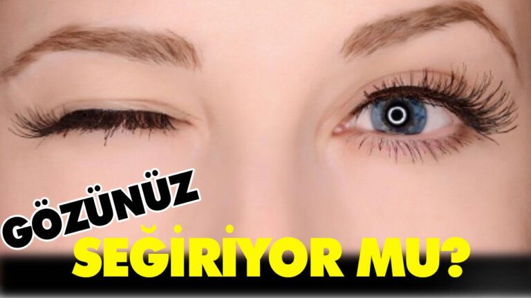 GÖZ SEĞİRMESİ NEDEN OLUR?