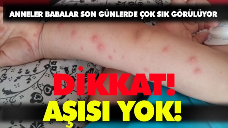 El ayak ağız hastalığı