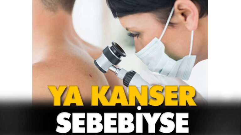VÜCUDUNUZDAKİ BENLERE DİKKAT!