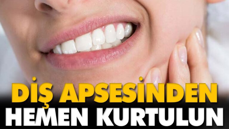 DİŞ APSESİ İÇİN ÖNERİLER