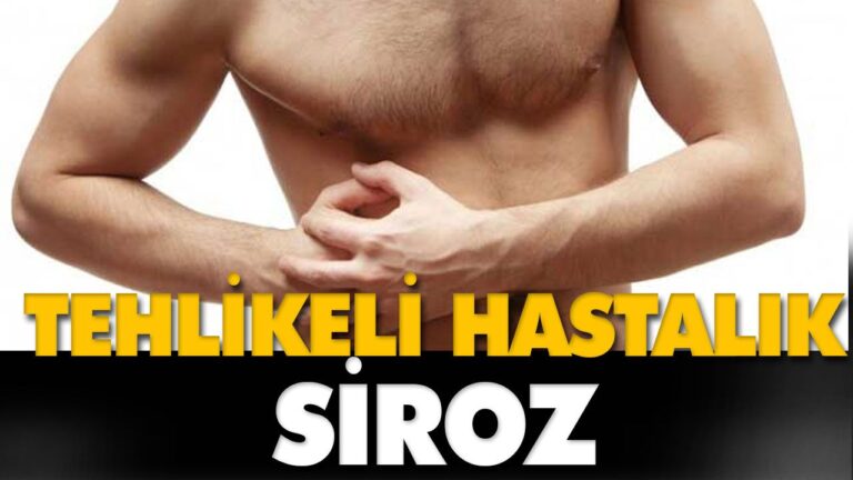 Siroz hastalığı nedir, sebepleri nelerdir?