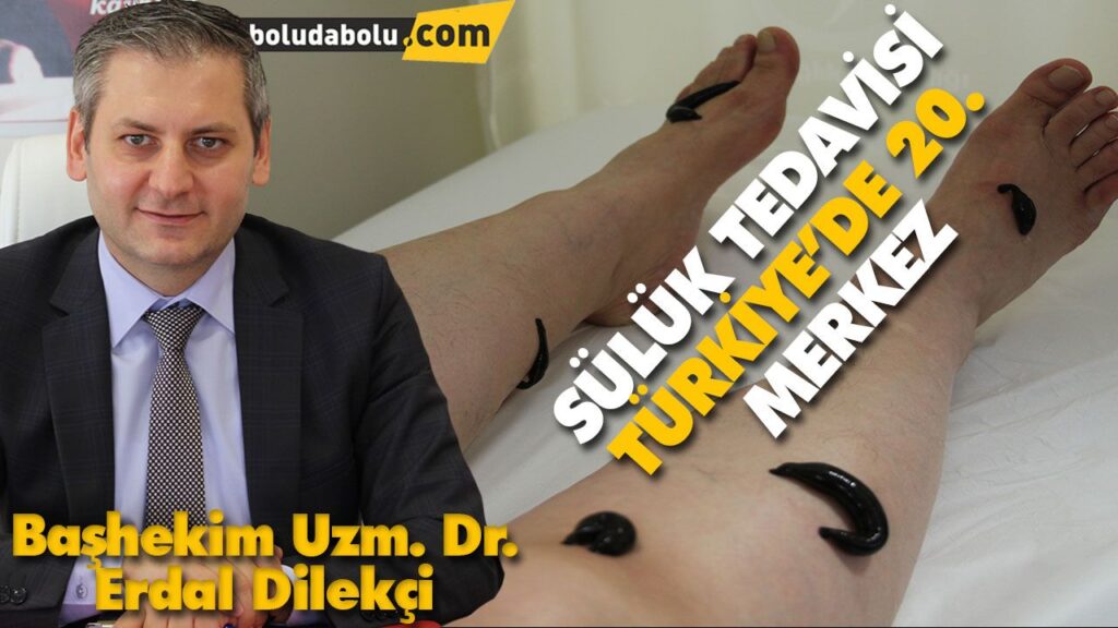 SÜLÜK TEDAVİSİ İLE HASTALAR ŞİFA BULUYOR SÜLÜK TEDAVİSİ İLE HASTALAR ŞİFA BULUYOR