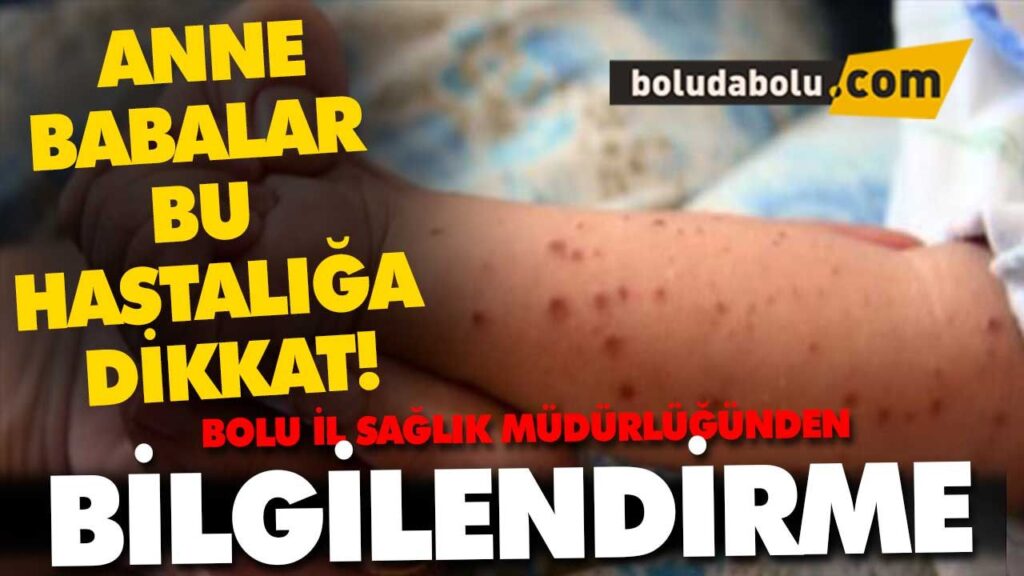 El Ayak Ağız Hastalığı El Ayak Ağız Hastalığı