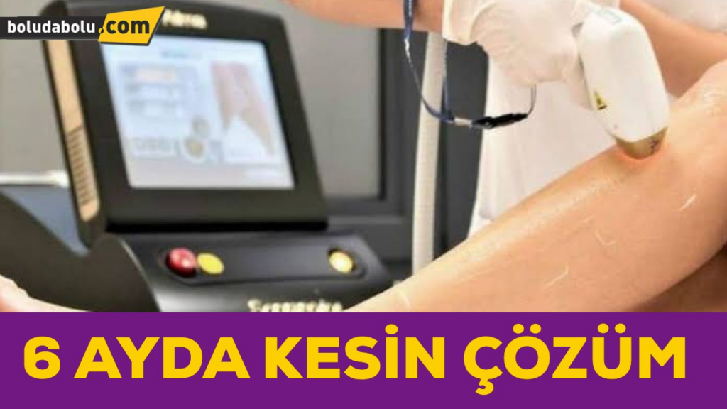BOLU’DA İLK VE TEKBUZ BAŞLIKLI DİODE LAZER ALTIN GÜZELLİK SALONUNDA BOLU’DA İLK VE TEKBUZ BAŞLIKLI DİODE LAZER ALTIN GÜZELLİK SALONUNDA