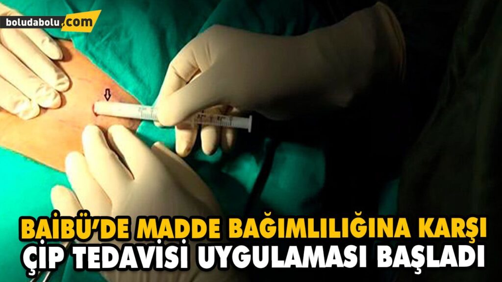 BAİBÜ’DE MADDE BAĞIMLILIĞINA KARŞI ÇİP TEDAVİSİ UYGULAMASI BAŞLADI BAİBÜ’DE MADDE BAĞIMLILIĞINA KARŞI ÇİP TEDAVİSİ UYGULAMASI BAŞLADI