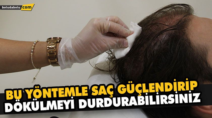 SAÇ MEZOTERAPİSİ NEDİR? SAÇ MEZOTERAPİSİ NEDİR?