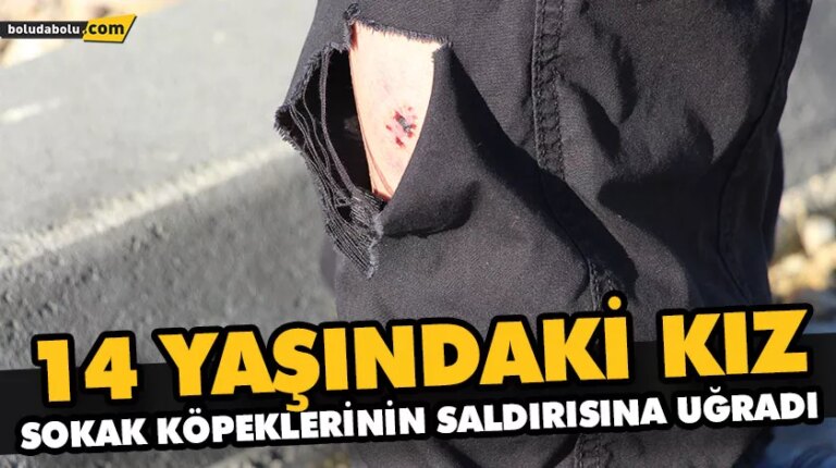 “ÇOK KORKTUM, KÖPEKLERE KARŞI BİR TRAVMAM OLDU”