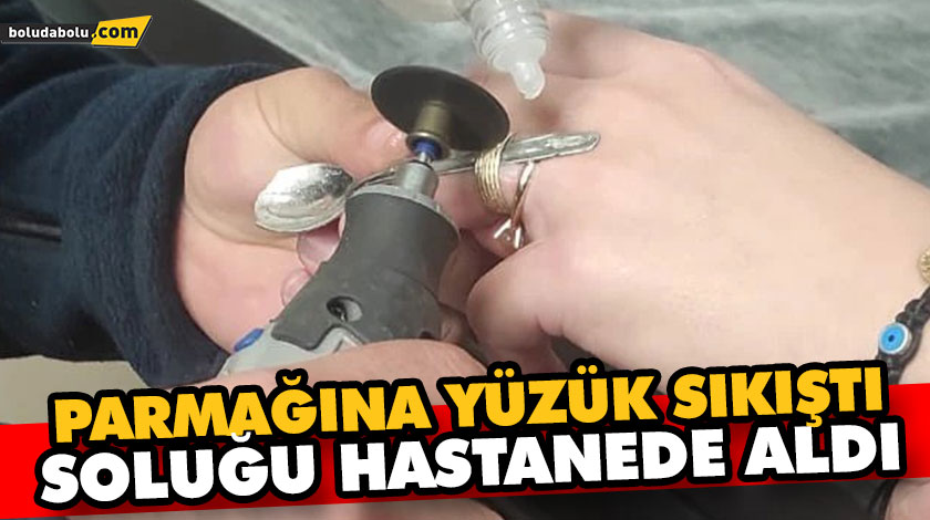 PARMAĞINA YÜZÜK SIKIŞTI, SOLUĞU HASTANEDE ALDI PARMAĞINA YÜZÜK SIKIŞTI, SOLUĞU HASTANEDE ALDI